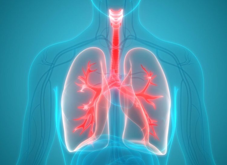poumon cancer