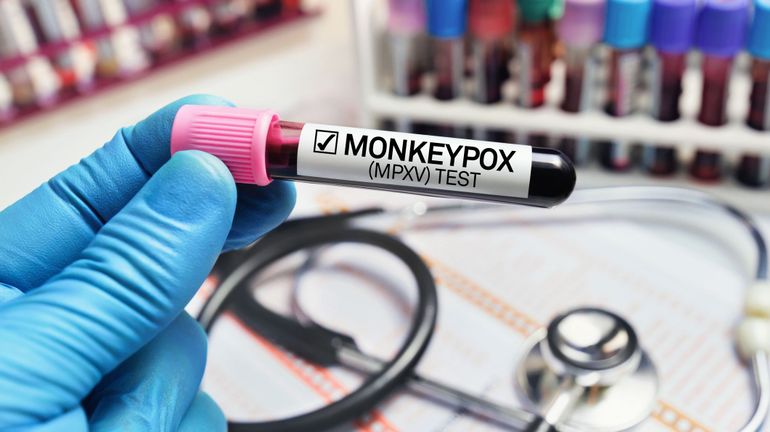 Variole des singes : Un nouveau kit de diagnostic pour contrer la propagation